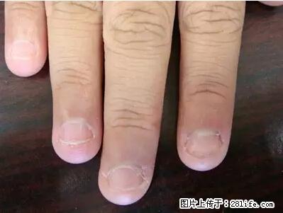 剪指甲、挖耳屎，这些日常小动作竟隐藏大危害！ - 仙桃生活资讯 - 仙桃28生活网 xiantao.28life.net